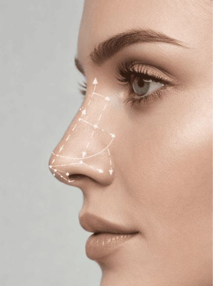 Resultados de Rinoplastia en Barcelona